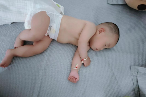 黔南宝宝头上长痱子